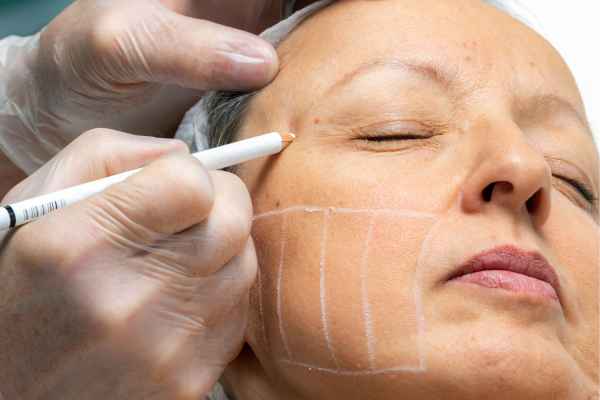 CryoPen: 5 Skin Concerns It May Be Used to Treat 4 What should you ask before having CryoPen treatment Little Paxton?